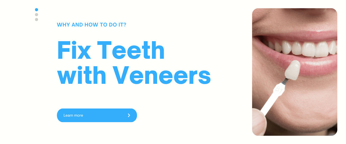 Исправление зубов с помощью виниров: зачем это делать и как делать это правильно